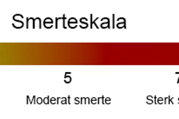 Smerteskala fra 0-10 hvorav 0 er ingen smerte, 3 er mild smerte, 5 er moderat smerte, 7 er sterk smerte og 10 er verst tenkelig