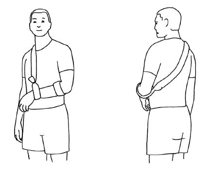 Figur av mann med armen i falte